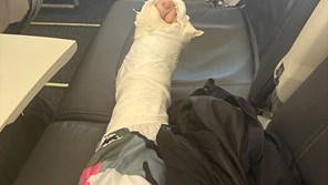 a broken leg in a cast elevated across three aeroplane seats